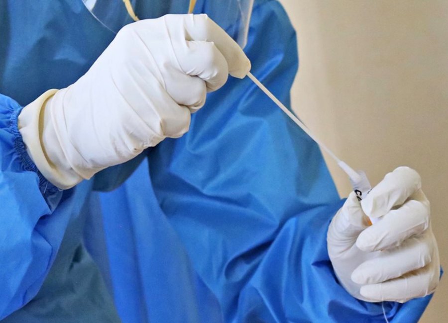 Saúde recebe 7.300 kits de exames para detecção da Covid-19
