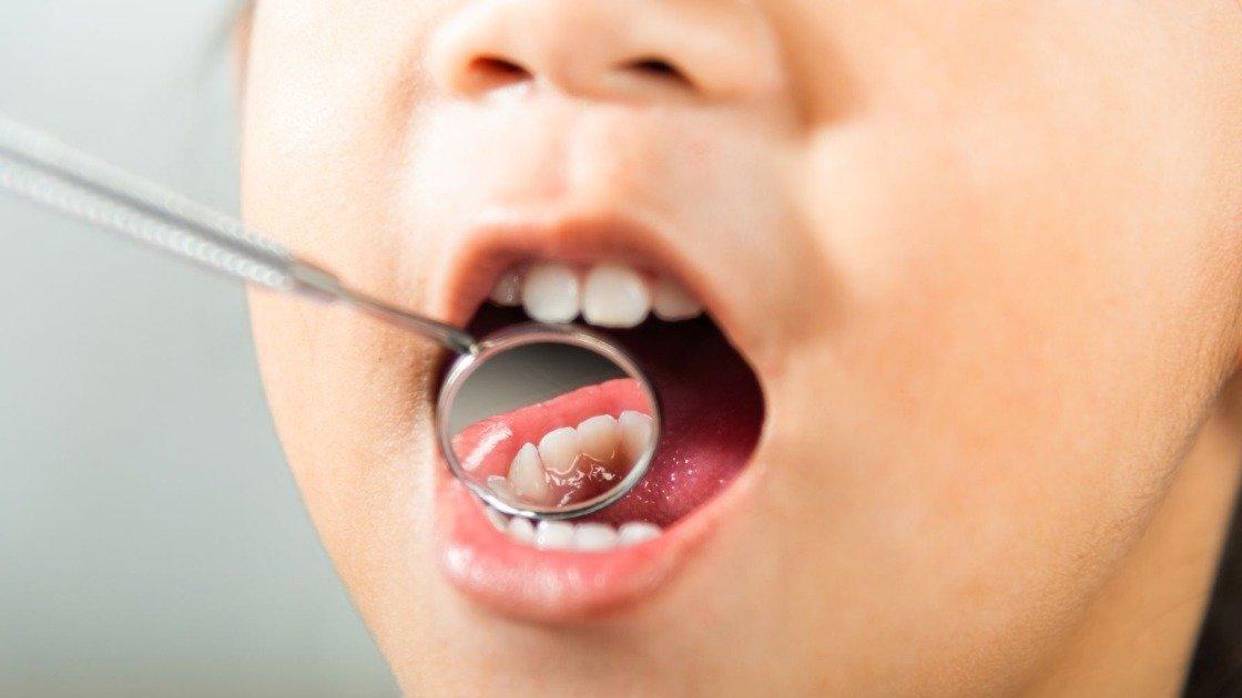 Ação de saúde bucal será realizada em escola rural